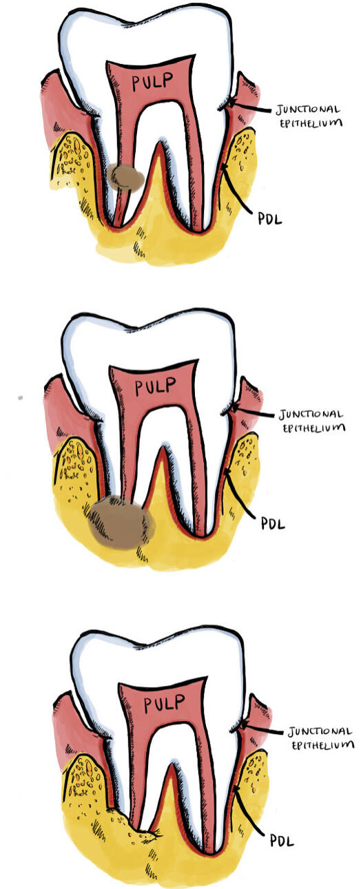 Illustration of three teeth